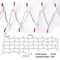 100 Pieces Christmas Pink Mini String Lights - 25 Feet Detachable Incandescent Bulb Waterproof Fairy Lights Plug in for Indoor Outdoor Party Patio Xmas Tree Valentine's Day Decoration, White Wire